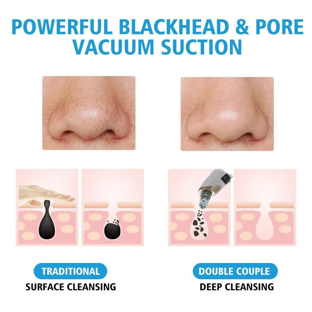 Electric Facial Blackhead Remover Vacuum Pore Cleaner Acne Cleanser Black Spots Removal Face Nose Deep Cleaning tools